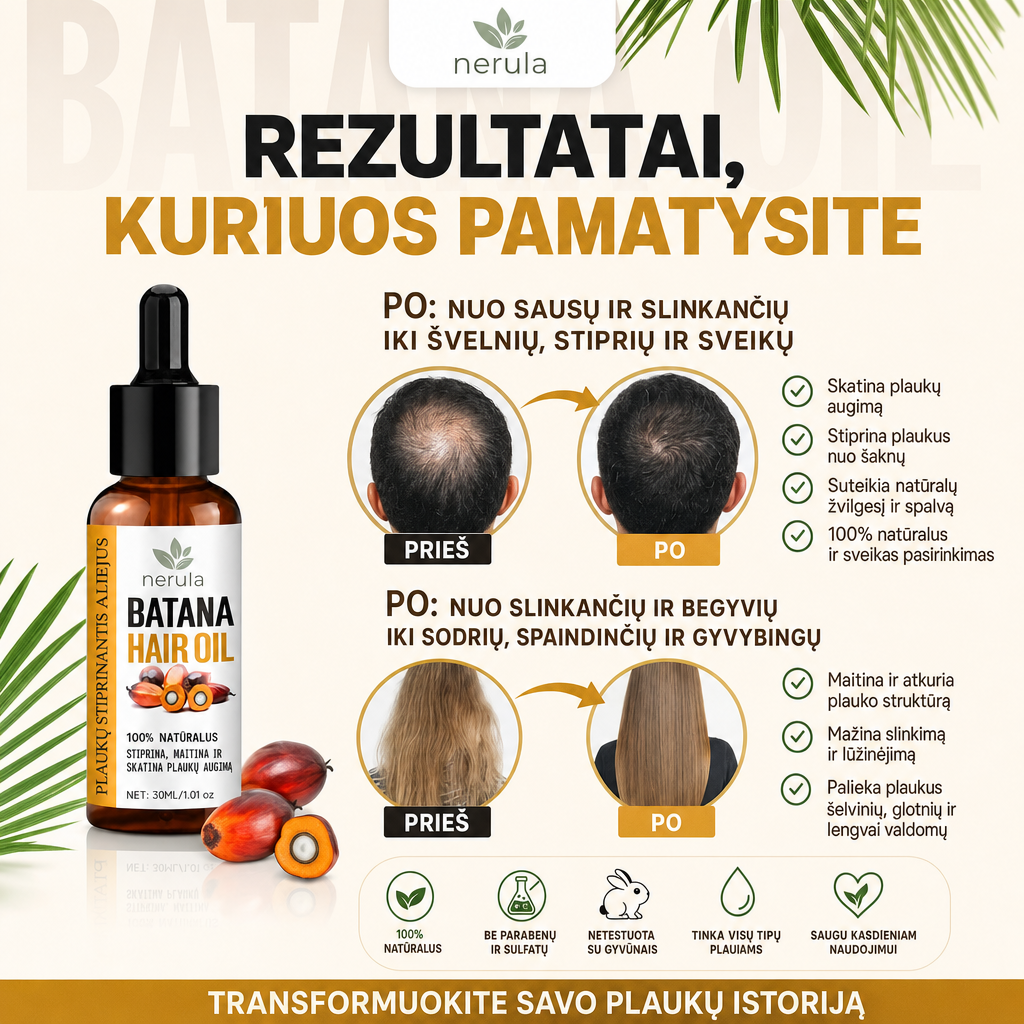 Plaukai Retėja Ir Tai Jau Matosi?